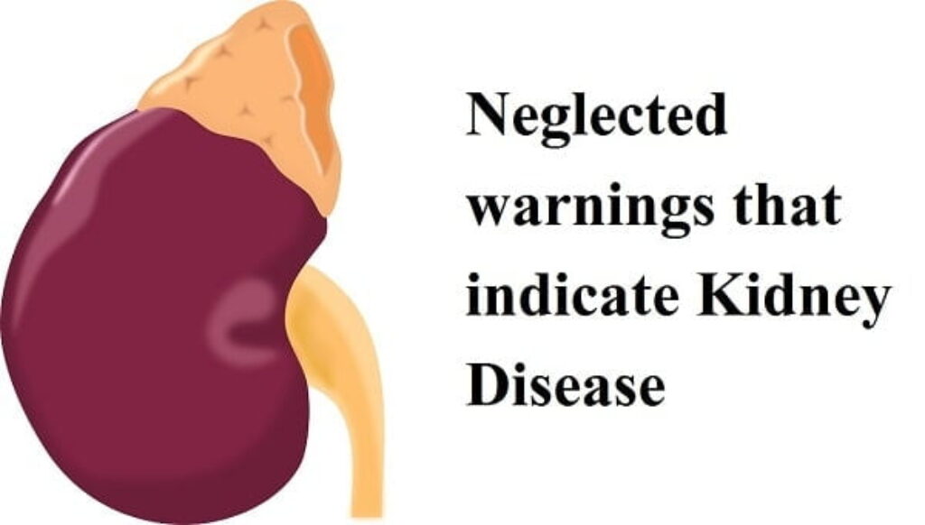 kidney disease indications, kidney failure treatment, how to prevent kidney failure, Know about kidney disease indications